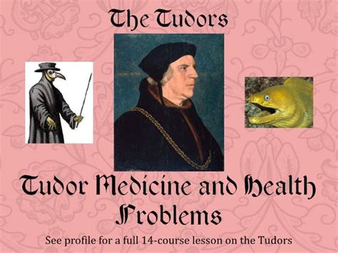 tudor medicine history.